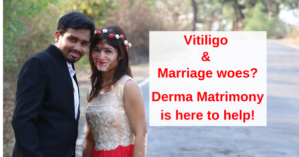 Vitiligo Marriage Derma Matrimony